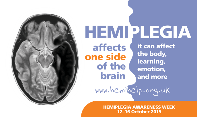 hemiplegia-image-website-SJ-1